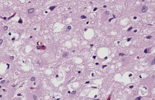 Urocortin 3 EIA, Mouse and Rat